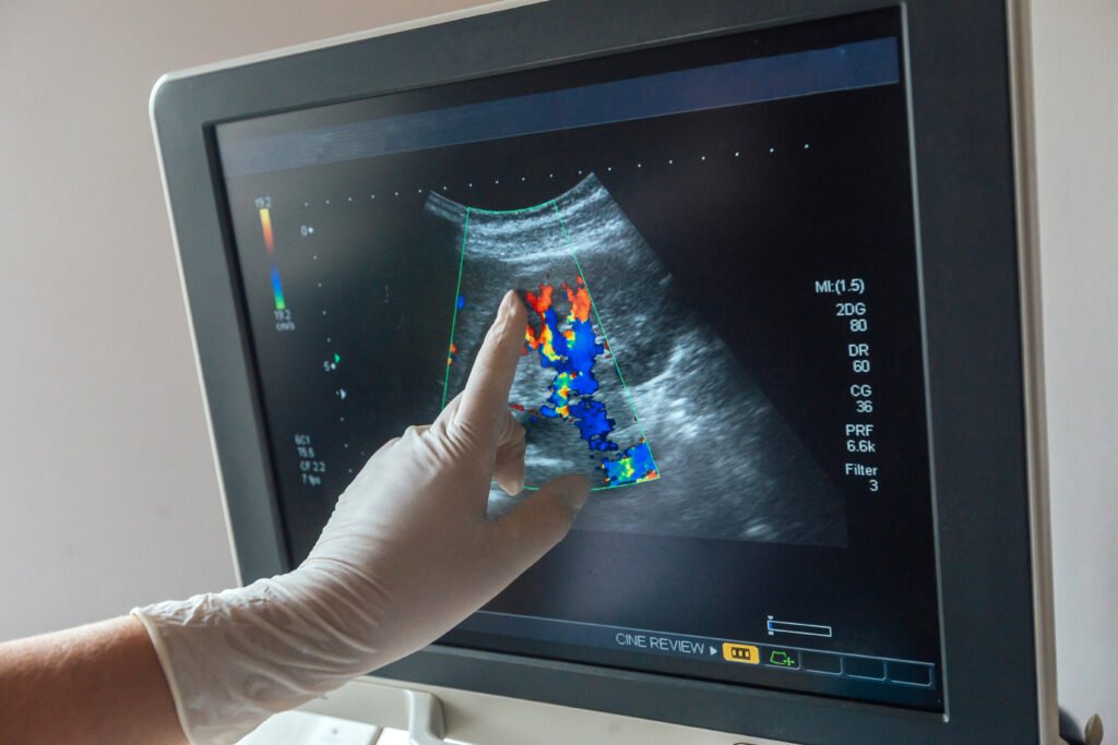 Colour Doppler Test Andheri | Vascular Ultrasound