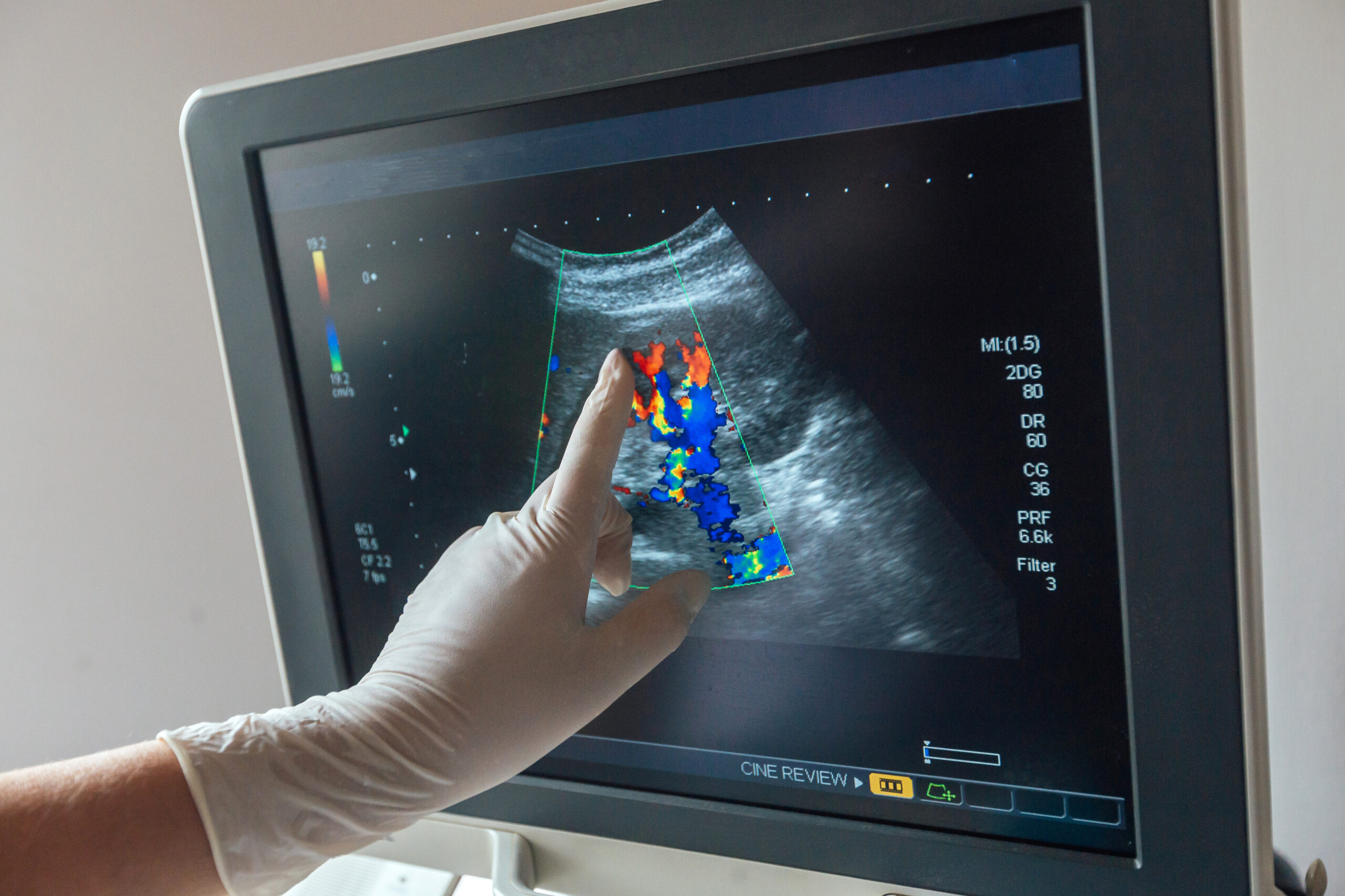 Colour Doppler Test Work