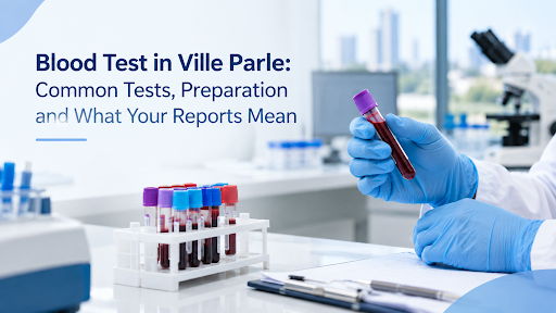 Blood Test in Ville Parle Common Tests